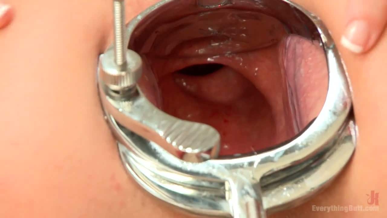 inside asshole rectum