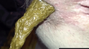 close-up of an anus shitting