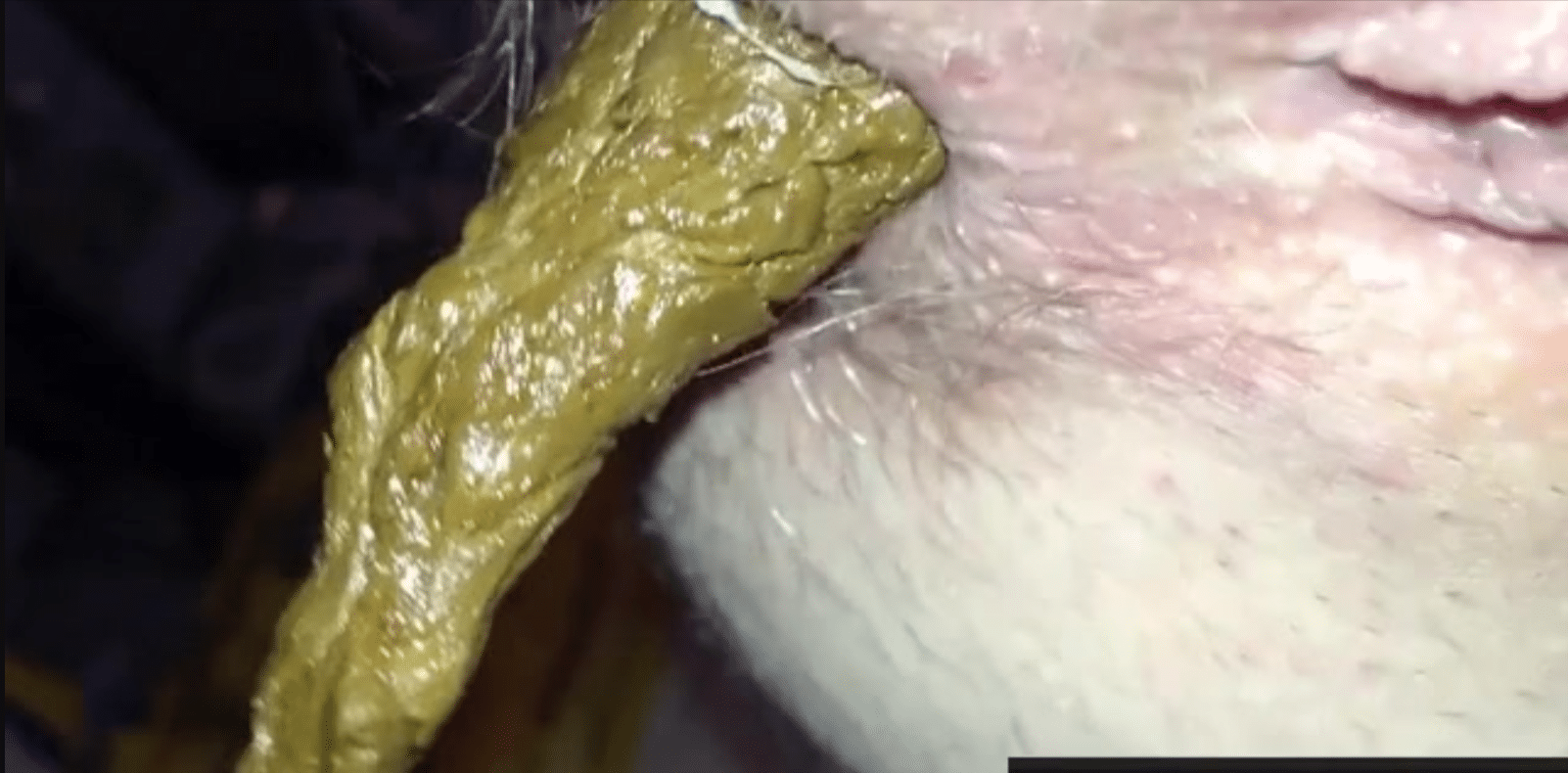 close-up of an anus shitting