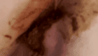 CLOSE-UP OF ANUS OPENING FOR A SHIT