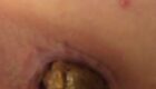 Shit coming out of your ass in close-up