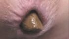 JAPANESE SHITTING CLOSE UP